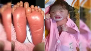 दुनिया रंग बिरंगी Woman gives birth to a plastic baby.